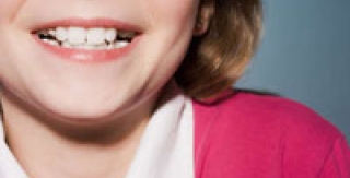 Chứng nghiến răng một cái nhìn tổng quát