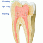 Tại sao phải lấy tủy răng ( nội nha ) ? 