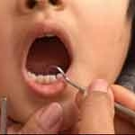Chăm sóc răng cho trẻ nhỏ