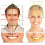 Thiết kế nụ cười đẹp (Smile Design)