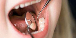 Tại sao cần phải bỏ công để trám những răng cối sữa?