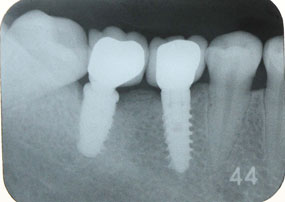 x-ray01