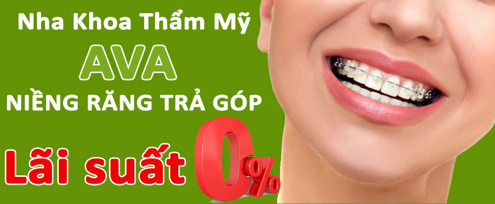 nieng rang tra gop