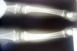 ngo-doc-chi-2