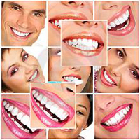 can-dat-bao-nhieu-implant